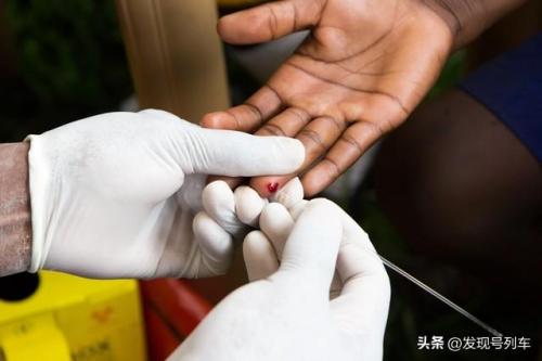 全球十大高发疾病排行榜(盘点历史上世界十大传染病)插图9