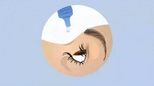 眼干涩滴眼液十大排行榜(眼睛干涩是肝火还是肝血不足)插图4