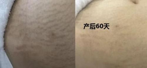 十大孕妇专用品排行榜图片(孕妇专用隔离霜排行榜)插图14