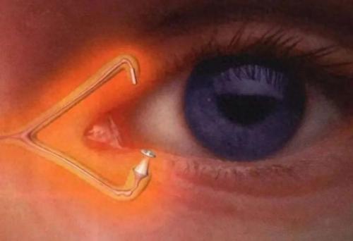 眼干涩滴眼液十大排行榜(眼睛干涩是肝火还是肝血不足)插图2