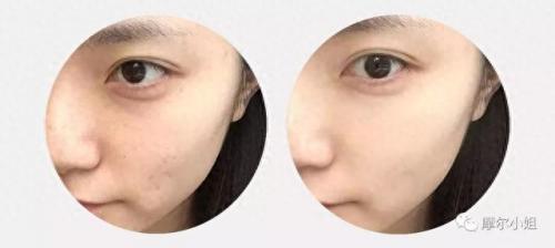 十大轻奢素颜霜排行榜(为什么不建议用素颜霜)插图21