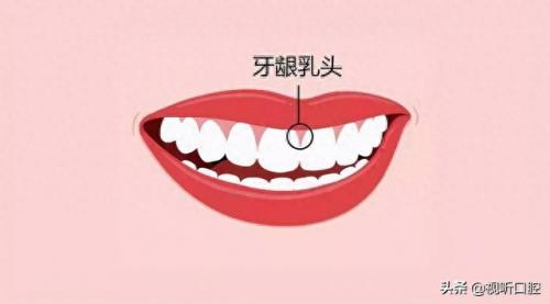 排名前十的牙疼(治牙疼最快的土方法)插图9