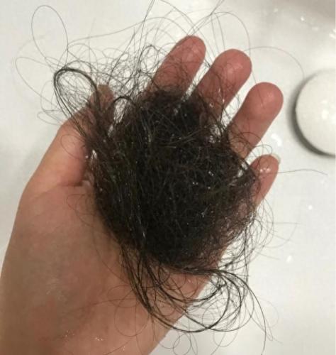 阿道夫洗发水脱发是真的吗(央视新闻报道阿道夫洗发水)插图2