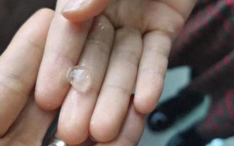 东莞下冰雹(广东下冰雹)