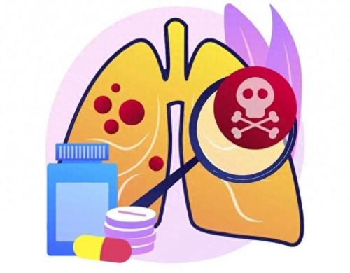 所有杀手排名前十(杀手排行榜前10名)插图5