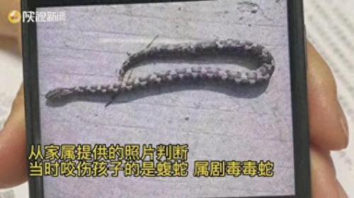 毒蛇咬女儿治病(河北毒蛇分布地图)插图