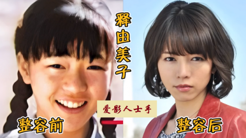 日本明星整型排名前十(日本海边明星)插图15