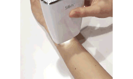 面部永久脱毛方法(家庭最简单的永久脱毛)插图22