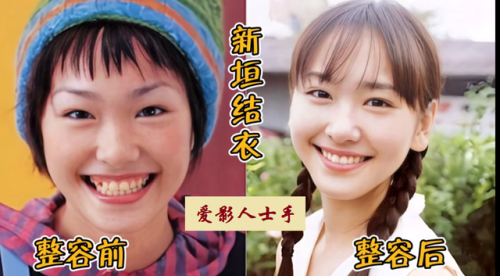 日本明星整型排名前十(日本海边明星)插图7
