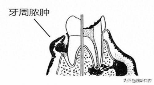 排名前十的牙疼(治牙疼最快的土方法)插图8
