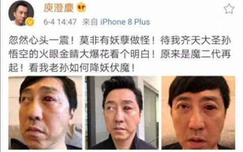 大眼睛 庾澄庆(庾澄庆独眼)