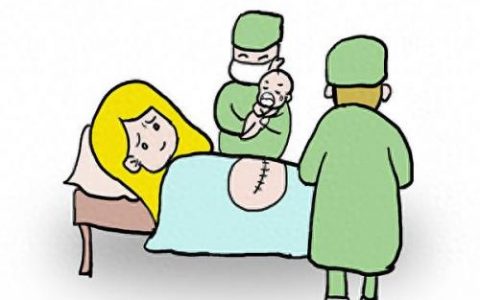 剖腹产新生儿护理(剖腹产新生儿的日常护理)