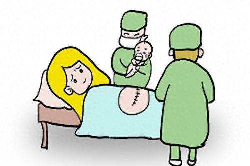 剖腹产新生儿护理(剖腹产新生儿的日常护理)插图