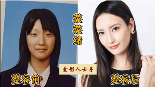日本明星整型排名前十(日本海边明星)插图16