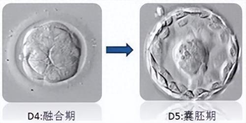 囊胚质量排名前十(囊胚的质量怎么样)插图