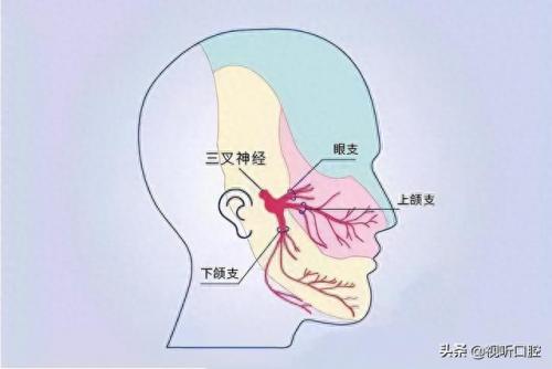 排名前十的牙疼(治牙疼最快的土方法)插图10
