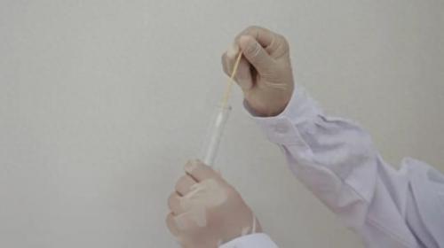 女性阴道检查(男医生做阴道镜可以投诉吗)插图2