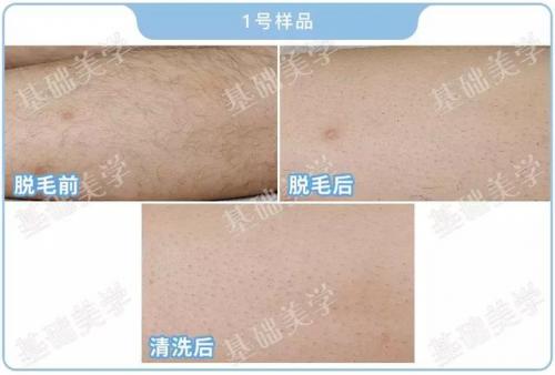 哪种脱毛膏好用(目前公认最好的脱毛膏)插图17