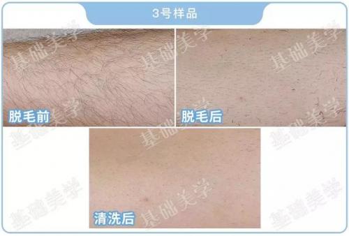 哪种脱毛膏好用(目前公认最好的脱毛膏)插图19