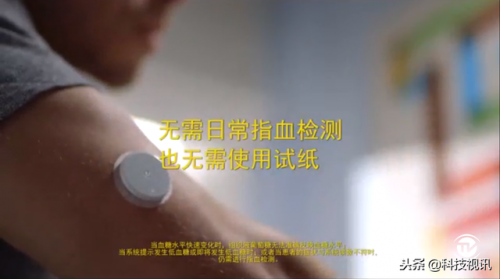 扫描式血糖检测仪价格(胳膊上戴的血糖仪多少钱)插图15