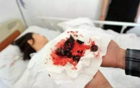 电脑椅爆炸(办公椅气杆爆炸)
