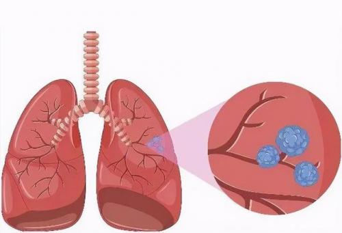 世界化疗费用排名前十(2019世界企业研发投入排行)插图3