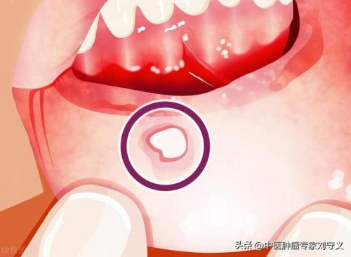 女贞子的功效与作用及食用方法(女贞子最佳配伍菟丝子)插图2