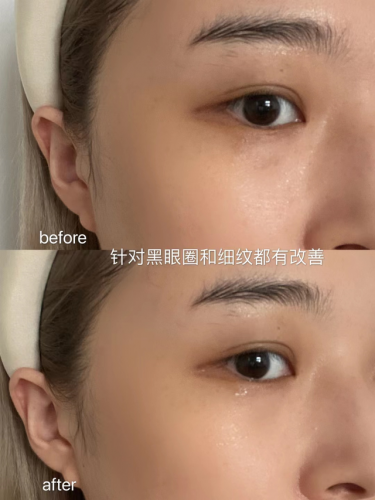 什么牌子眼霜好用(十大公认好用眼霜排行榜)插图14