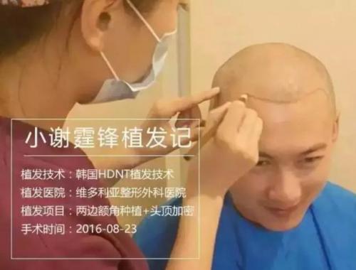 合肥头发医生排名前十(合肥好评医生排名)插图3