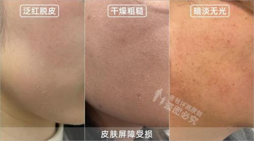 抗衰精华液排行榜(哪个品牌精华液抗衰老比较好)插图2