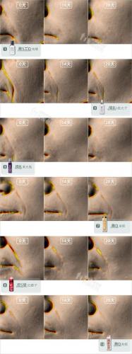 抗衰精华液排行榜(哪个品牌精华液抗衰老比较好)插图16