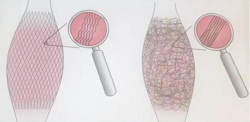 筋膜枪十大品牌排行榜(筋膜枪哪个牌子好)插图1