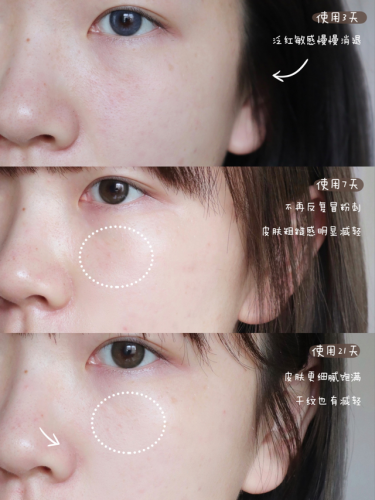 不兰花面霜排行榜(好用的面霜公认最好用)插图4