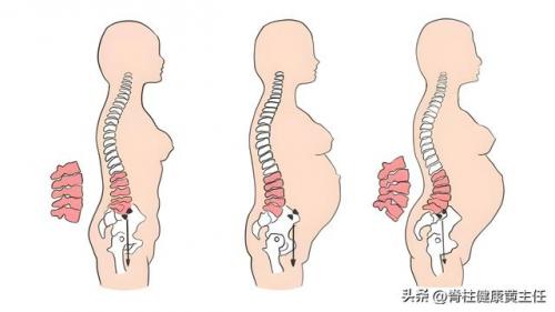 尾巴骨疼是怎么回事(男性尾巴根疼痛什么原因)插图1
