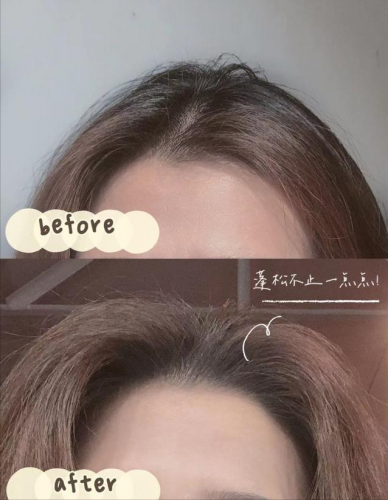 去油脂洗发水排行榜(排名第一的控油洗发水)插图13
