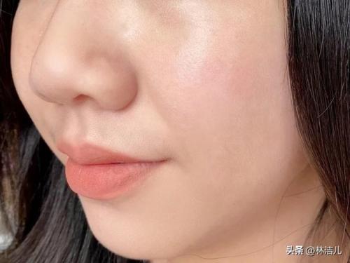 鱼腥草精华液排行榜(鱼腥草的护肤功效与作用)插图10