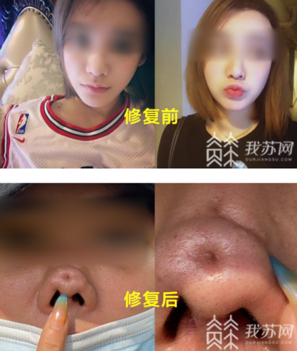 南京整容排行榜(南京十大整形医院排名)插图
