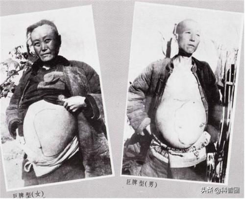 动物杀人排行榜(最致命的动物)插图13