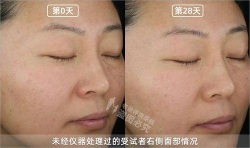 抗衰精华液排行榜(哪个品牌精华液抗衰老比较好)插图18