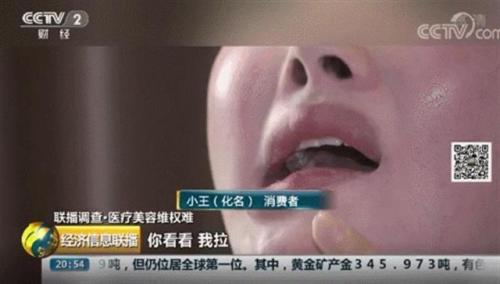 武汉疤痕医院排行榜(武汉哪里治疗疤痕最好的医院)插图2