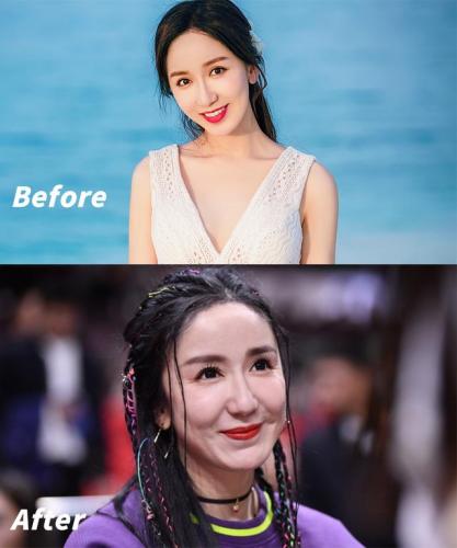 明星整容失败案例(因为整容而毁容的明星有哪些)插图20