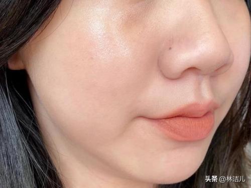 鱼腥草精华液排行榜(鱼腥草的护肤功效与作用)插图18