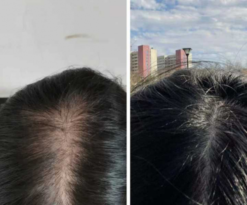 小红书洗发水排行榜(十大公认最好的洗发水)插图3