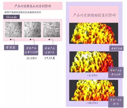 水啫喱面霜排行榜(啫喱面霜和保湿面霜有什么区别吗)插图4