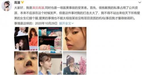 明星整容失败案例(因为整容而毁容的明星有哪些)插图34
