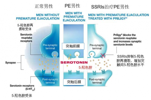 盐酸达泊西汀片有什么功效和作用呢(非那雄胺片对男性性功能有影响吗)插图2