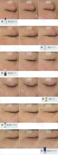 抗衰精华液排行榜(哪个品牌精华液抗衰老比较好)插图12