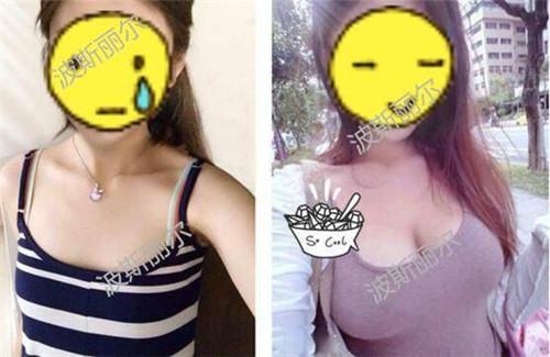丰胸效果最好的产品排行榜(全国排名第一的丰胸产品)插图