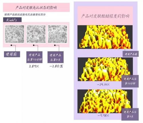 水啫喱面霜排行榜(啫喱面霜和保湿面霜有什么区别吗)插图7