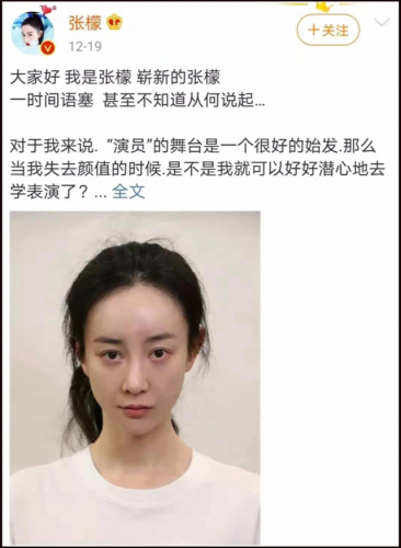 明星整容失败案例(因为整容而毁容的明星有哪些)插图30
